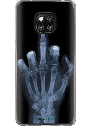 Чехол на huawei mate 20 pro рука через рентген "1007u-1567-10746"