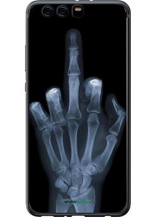 Чехол на huawei p10 plus рука через рентген "1007u-963-10746"