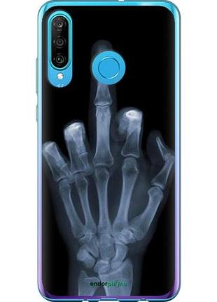 Чехол на huawei p30 lite рука через рентген "1007u-1651-10746"