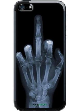 Чехол на iphone 5s рука через рентген "1007u-21-10746"