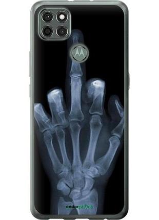 Чохол на motorola g9 power рука через рентген "1007u-2229-10746"