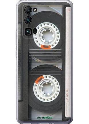 Чехол на huawei honor 30 pro кассета "876u-1920-10746"