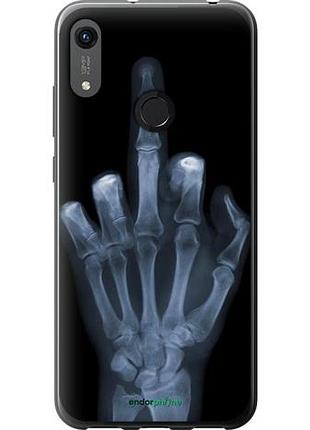 Чехол на huawei honor 8a рука через рентген "1007u-1635-10746"