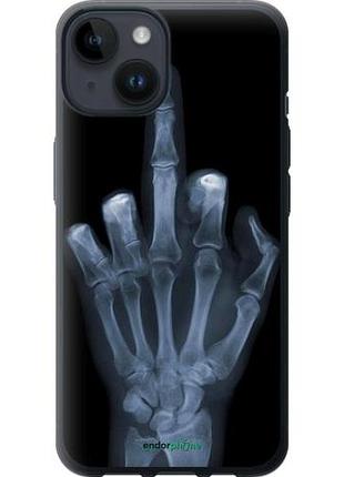 Чехол на iphone 14 рука через рентген "1007u-2648-10746"