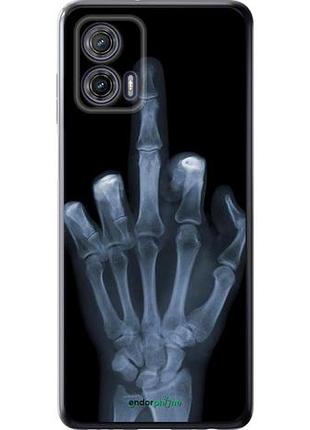 Чохол на motorola g73 рука через рентген "1007u-3196-10746"