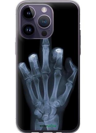 Чехол на iphone 14 pro max рука через рентген "1007u-2667-10746"