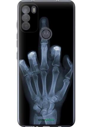 Чехол на motorola g50 рука через рентген "1007u-2354-10746"
