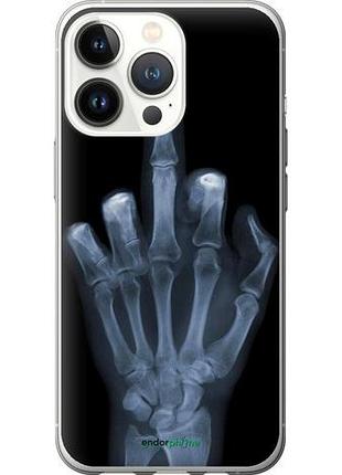 Чохол на iphone 13 pro рука через рентген "1007u-2372-10746"