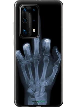 Чохол на huawei p40 pro plus рука через рентген "1007u-1917-10746"