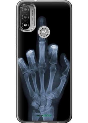 Чехол на motorola e20 рука через рентген "1007u-2509-10746"