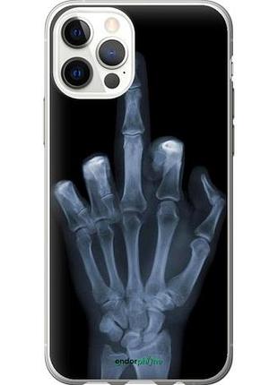 Чохол на iphone 12 pro рука через рентген "1007u-2052-10746"