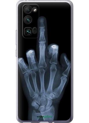 Чохол на huawei honor 30 pro рука через рентген "1007u-1920-10746"
