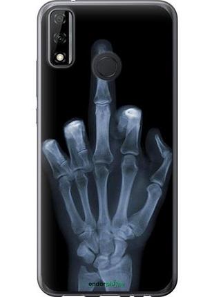Чохол на huawei p smart 2020 рука через рентген "1007u-2060-10746"