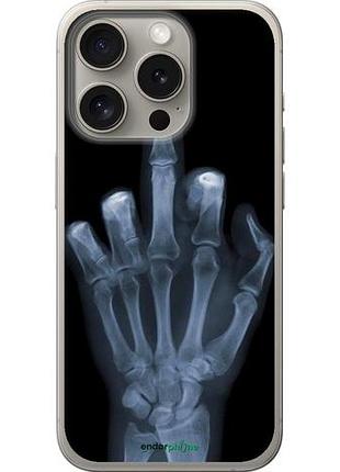 Чехол на iphone 15 pro рука через рентген "1007u-3096-10746"
