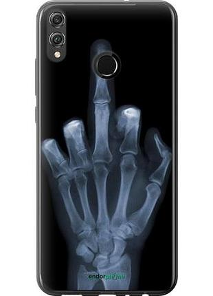 Чехол на huawei honor 8x рука через рентген "1007u-1596-10746"