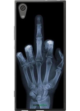 Чехол на sony xperia xa1 g3112 рука через рентген "1007u-964-10746"