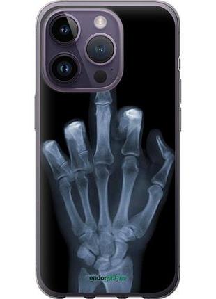 Чехол на iphone 14 pro рука через рентген "1007u-2646-10746"