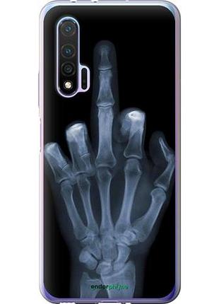 Чехол на huawei nova 6 рука через рентген "1007u-1821-10746"