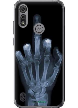 Чехол на motorola e6i рука через рентген "1007u-2355-10746"