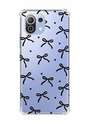 Чехол с утолщёнными углами на xiaomi mi 11 lite бантики (принт 405)