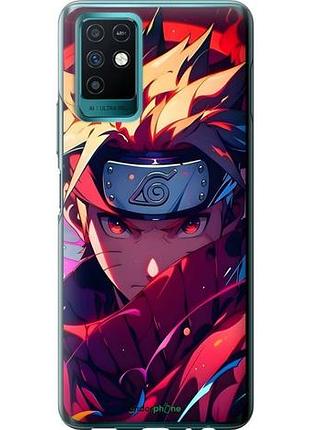 Чехол на infinix note 10 наруто naruto инфикс ноут 10
