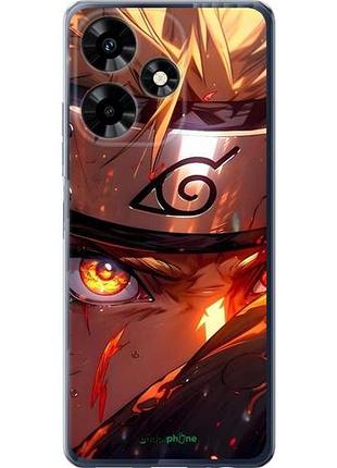 Чехол на infinix hot 30 наруто naruto инфикс хот 30