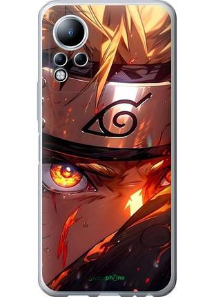 Чехол на infinix note 11 наруто naruto инфикс ноут 11