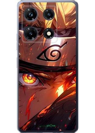 Чохол на infinix note 30 pro наруто