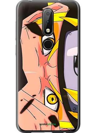 Чехол на nokia 6.1 plus наруто naruto 2 нокиа 6.1 плюс 2