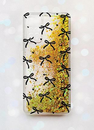 Чехол с плавающими золотыми блестками на xiaomi redmi note 11 pro бантики (принт 405)