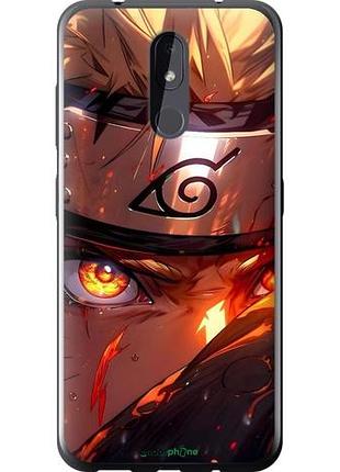 Чехол на nokia 3.2 наруто naruto нокиа 3.2