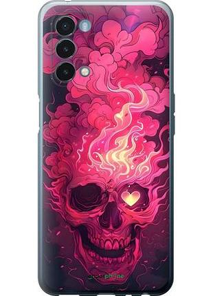 Чехол на oneplus nord n200 5g череп арт 1+ норд н200 5г