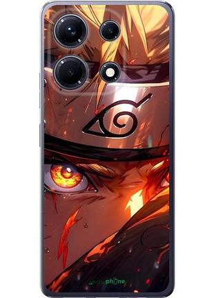 Чехол на infinix note 30 наруто naruto инфикс ноут 30