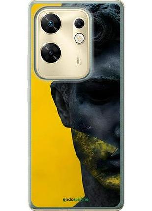 Чохол на infinix zero 30 4g статуя арт