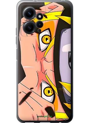 Чехол на xiaomi redmi note 12 4g наруто naruto 2 сяоми редми ноут 12 4г 2