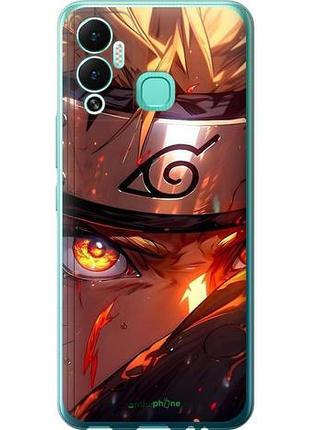 Чехол на infinix hot 12 play наруто naruto инфикс хот 12 плей