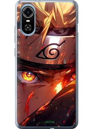 Чехол на zte blade a31 plus наруто naruto зте блейд а31 плюс
