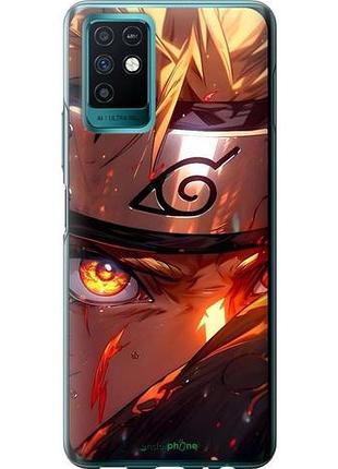Чехол на infinix note 10 наруто naruto инфикс ноут 10
