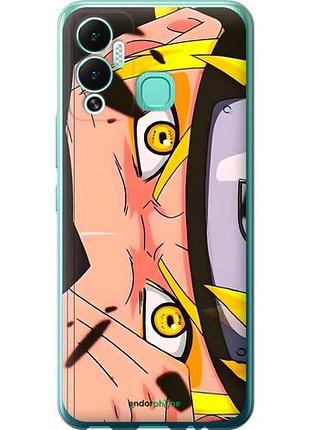Чехол на infinix hot 12 play наруто naruto 2 инфикс хот 12 плей 2