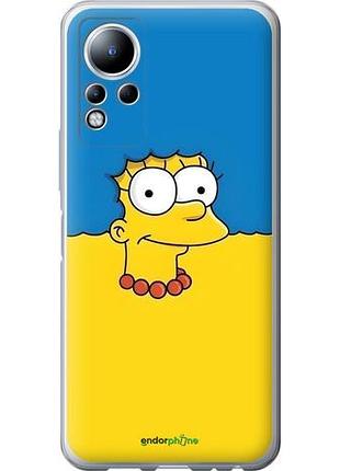 Чехол на infinix note 11 мардж флаг украины инфикс ноут 11