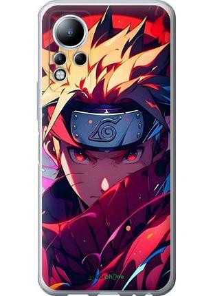 Чехол на infinix note 11 наруто naruto инфикс ноут 11