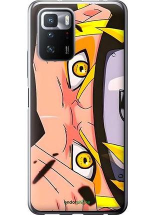 Чехол на xiaomi poco x3 gt наруто naruto 2 сяоми поко х3 гт 2