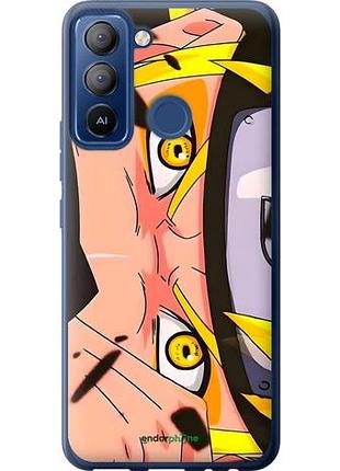 Чохол на tecno pop 5 lte bd4 наруто 2
