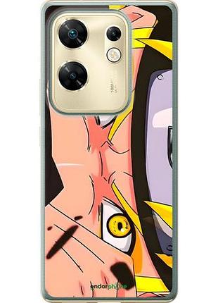 Чохол на infinix zero 30 4g наруто 2