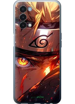 Чехол на oneplus nord n200 5g наруто