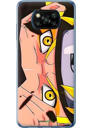 Чехол на xiaomi poco x3 наруто naruto 2 сяоми поко х3 2