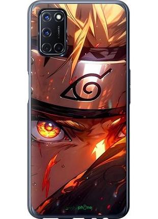 Чехол на oppo a52 наруто naruto оппо а52