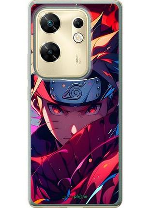 Чохол на infinix zero 30 4g наруто