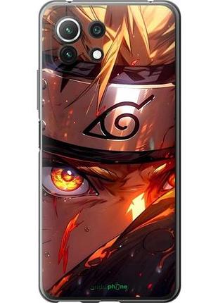 Чехол на xiaomi mi 11 lite наруто naruto сяоми ми 11 лайт