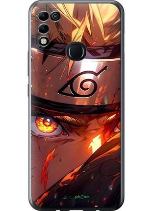 Чехол на infinix hot 11 play наруто naruto инфикс хот 11 плей